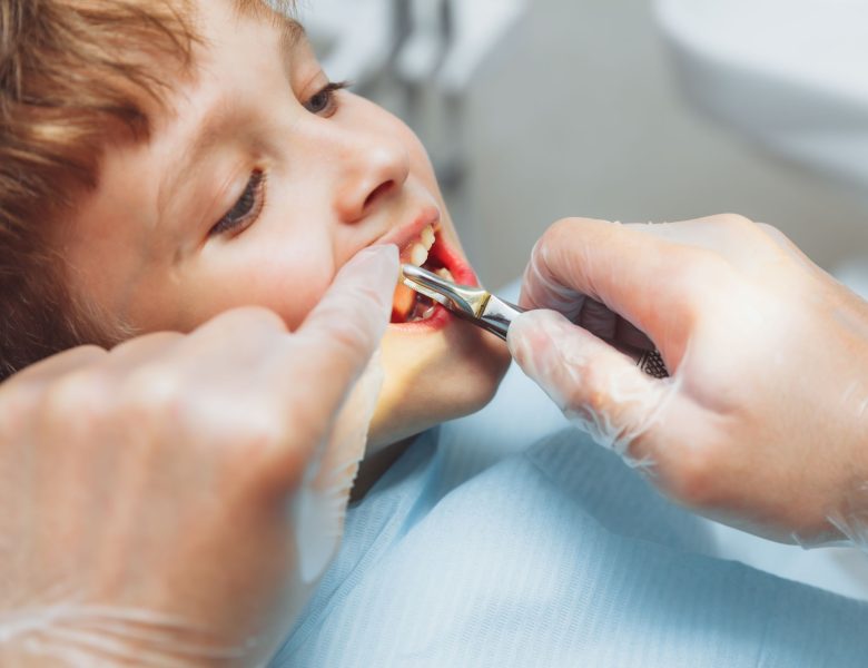 Pediatric Oral Surgery: Ensuring Comfort and Safety for Young Patients in Passaic, NJ