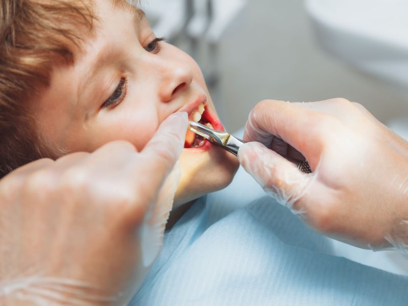 Pediatric Oral Surgery: Ensuring Comfort and Safety for Young Patients in Passaic, NJ